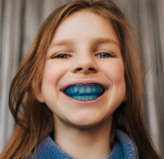 bite-guards-overland-park-ks